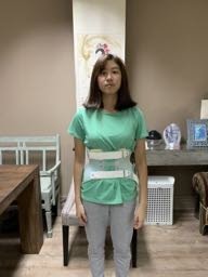 bo1-1 Bệnh nhân mặt áo nẹp 3D ở Bones and Beyond