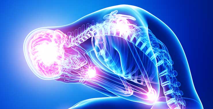 body-stress-title-image_tcm7-230134 Bệnh nhân cong vẹo cột sống có vấn đề về cảm xúc