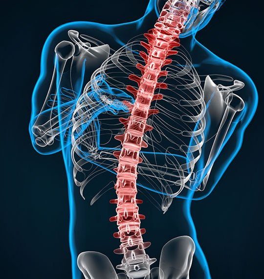 cscoliosis Diagram Scoliosis