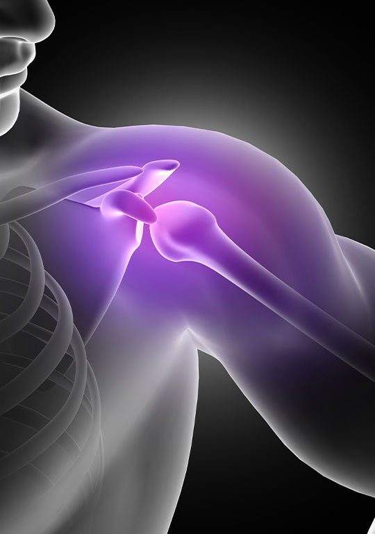 shoulderpain Shoulder Pain