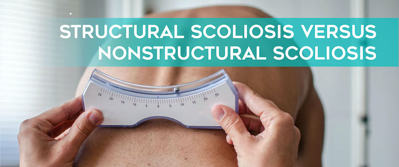 structural-scoliosis-versus-nonstructural-scoliosis-01 Cách đo đọ cong vẹo