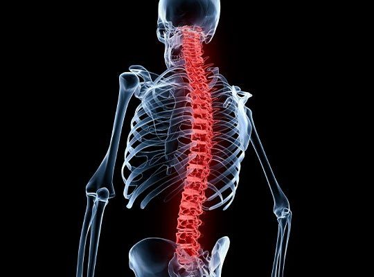 subluxations